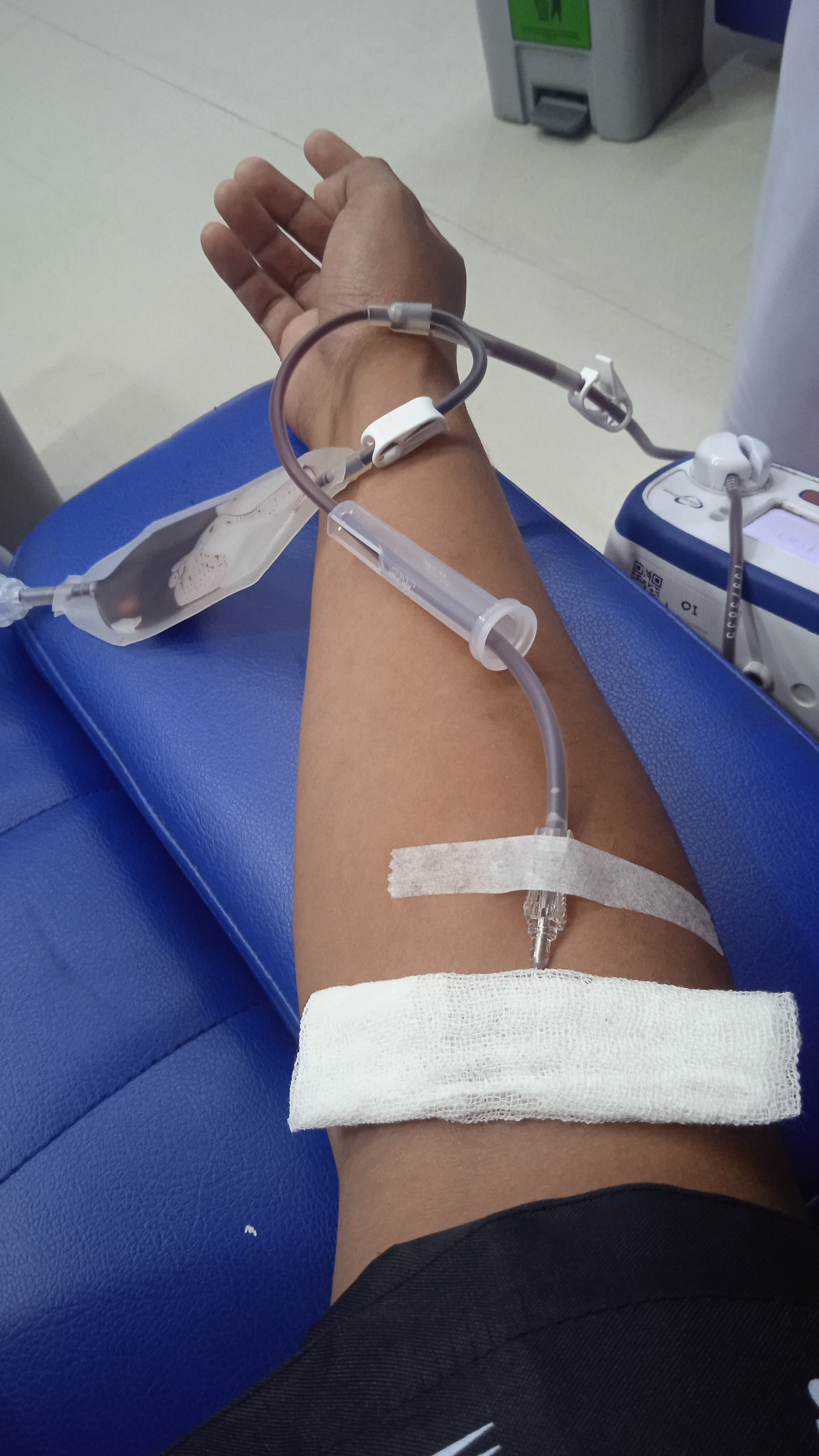 lengan dengan suntikan di bagian lengan, darah keluar dari suntikan dan selang